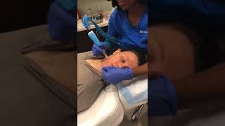 Microneedling with PRP