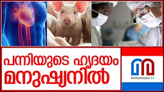 പന്നിയുടെ ഹൃദയം മനുഷ്യനില്‍ l pig heart into human patient