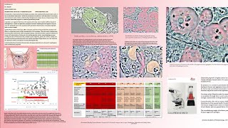 Periodontitis history of a dysbiosis and Cure. Slides.