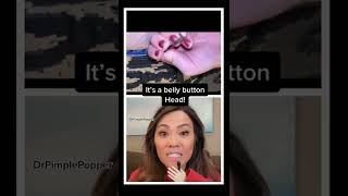 Dr Pimple Popper POPS Belly Button Comedone!