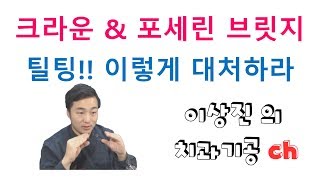 [이상진ch 썰방 클립] 크라운 포세린 브릿지 틸팅 대처법