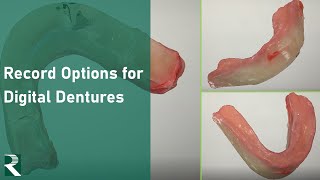 Record Options for Digital Dentures: Records for Full Denture Workflow