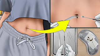 How To Remove A Huge Navel Stone Animation !! asmr video