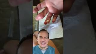 DOCTOR REACTS TO EXPLOSION OF ? FROM FINGER!😱 #shorts