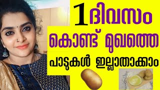 1 ദിവസം കൊണ്ട് ഉരുളക്കിഴങ്ങ് പായ്ക്  മുഖത്തെ പാടുകൾ മാറാൻ💯Natural Home remedies clear, glowing