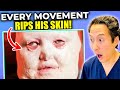 Plastic Surgeon Reacts to Man Whose Skin Falls Apart! EXTREME Bodies Explained!