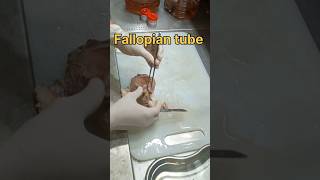 Fallopian tube biopsy sample| #கருமுட்டை குழாய் | #biopsy #treatmentforallbodyparts #fibroid