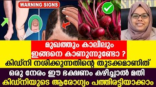 ഒരു നേരം ഈ ഭക്ഷണം കഴിച്ചാൽ മതി കിഡ്നിയുടെ ആരോഗ്യം പത്തിരട്ടിയാക്കാം - kidney stones malayalam