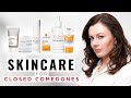 Effective Skincare Routine for Closed Comedones | Dr Sam Bunting