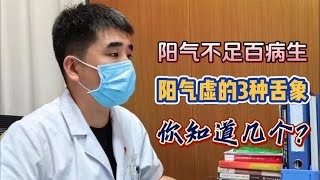 阳气不足百病生？阳气虚的3种舌象，你知道几个？