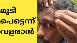 How To Grow Hair Faster Malayalam Tips || Hair || Sooraj's Hair Tips || Long Hair Mens ||Hair Growth