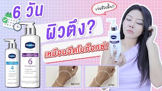 (กูรูเช็ค)รีวิว ครีมทาตัว Vaseline Pro Derma ที่(เคลมว่า) ลดริ้วรอย ผิวหย่อนคล้อย เข้มข้นที่สุด!!