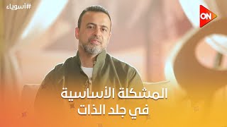 أسوياء مع مصطفى حسني - ‏‏المشكلة الأساسية في جلد الذات