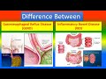 Difference between Gastroesophageal Reflux Disease (GERD) and Inflammatory Bowel Disease (IBD)