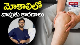 Swollen Knee: Causes, Treatment | Dr.Sai Chandra @MedPlusONETV