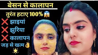 ऐसे लगाओ Besan Skin की सारी Problem khatm, Pigmentation \u0026 Dull Skin Treatment 😱