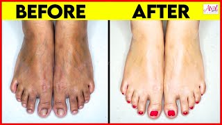Most Effective Tan Removal At Home | Detan Pack, Beauty Treatment, Instant Remedies, AvalGlitz