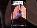 Chest tube insertion #shorts #ytshorts #anesthesia