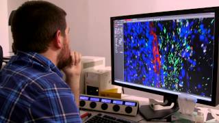 Researchers Find Altering Link Between Brain, Immune System