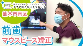 熊本市南区でマウスピース矯正による前歯の改善ならクリア総合歯科クリニック