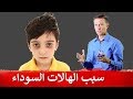 الهالات السوداء | سبب السواد تحت العين لدى الأطفال