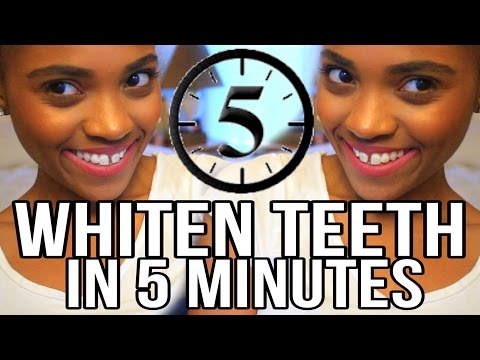 BEAUTY | How To Whiten Your Teeth in 5 Minutes! BEAUTY | How To Whiten Your Teeth in 5 Minutes!