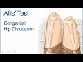 Allis' Test