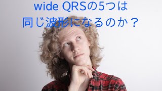 wide QRSの5つは全て同じ波形になるのか