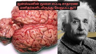 ஐன்ஸ்டீனின் மூளை எப்படி சாதாரண மனிதர்களிடமிருந்து வேறுபட்டது? | How Einstein's Brain was Different