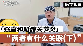 强直和骶髂关节炎两者之间有什么关联？听听肖医生怎么说(下)