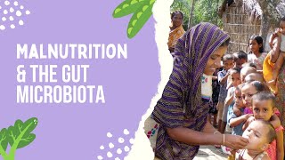 Malnutrition and the Gut Microbiota