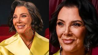 Kris Jenner Is PISSED About Her $300K Facelift… Regret & Everyone COPYING Her