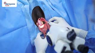 Basics of Colposcopy Procedure