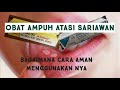 Obat Untuk Sariawan Paling ampuh || Kenalog orabase