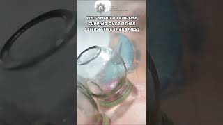 Performing Fire Cupping Therapy