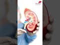 Tips to Prevent Contrast Nephropathy | Shorts | Kauvery Hospital