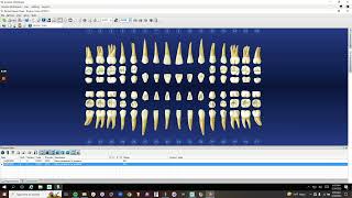 Denti.AI Auto-Chart Demo