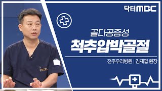 [닥터MBC] 골다공증성 척추압박골절 | 의학상식 | 전주MBC 230716 방송