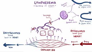 Lymphedema causes symptoms diagnosis treatment amp pathology