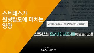 스트레스가 원형탈모에 미치는 영향 - (20180801_657회 방송) 毛자람에 대하여