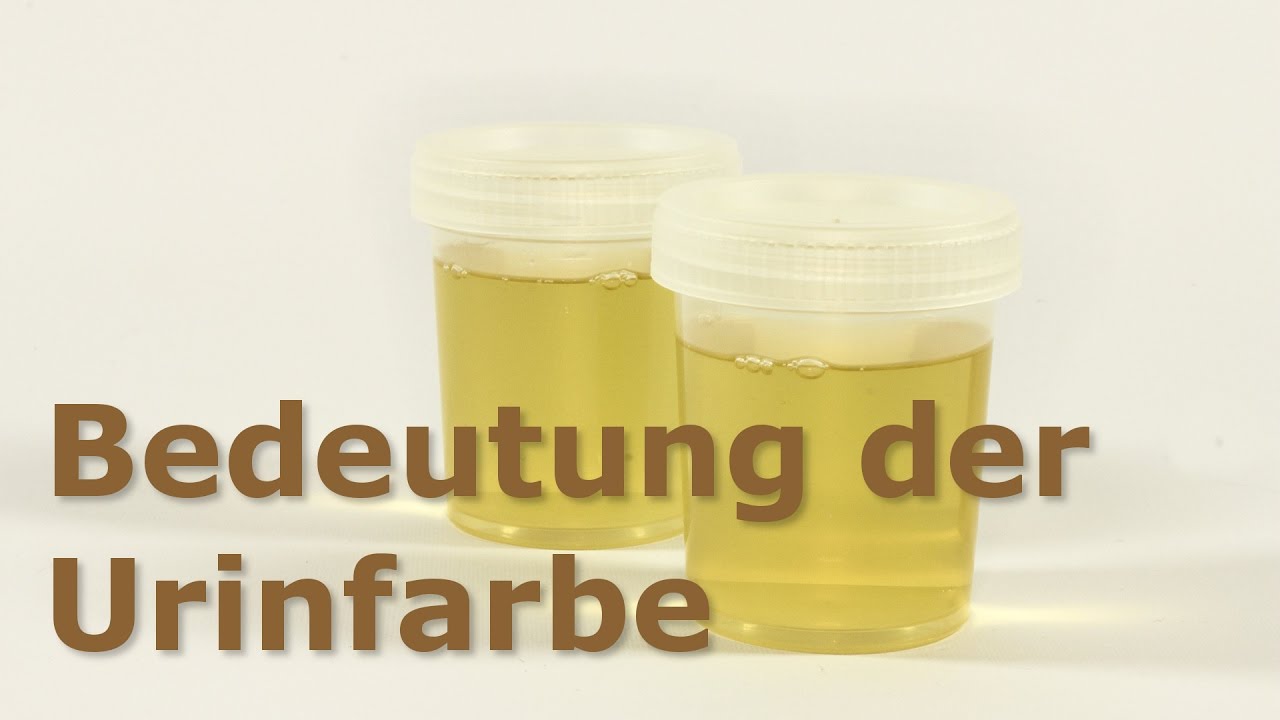 Was Bedeutet Die Farbe Des Urins? - YouTube