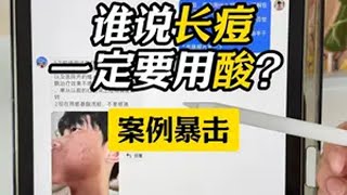 长痘一定要用酸么？ 谁说长痘一定要用酸？ 屏障问题为主的话，很多时候可以押后用屏障修护 淡化痘印 抗痘 刷酸 泛红痘印怎么消除