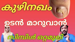 കുഴിനഖം എന്ന രോഗം ഉടൻ മാറുവാൻ സിമ്പിൾ  ഒറ്റമൂലി.