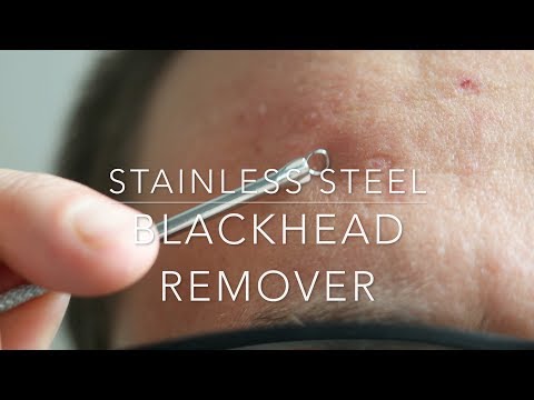 Stainless Steel Blackhead Acne Remover Stainless Steel Blackhead Acne Remover