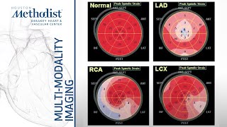 Role of Stress Echocardiography: Ischemia Evaluation and Beyond (M. Quiñones, MD) December 15, 2020