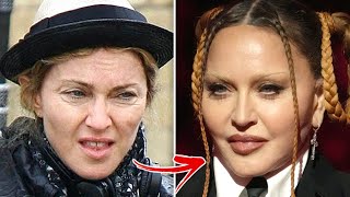 Unrecognizable Celebrities Who Lied About Having Plastic Surgery