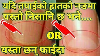 Nepali Health Tips Nailयदि तपाईको हातको नङमा यस्तो निसानि छ भने यो भिडियो हेर्नुस् यस्ता छन् फाईदा