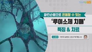 파킨슨병으로 혼동할 수 있는‘루이소체 치매’ 특징 \u0026 치료