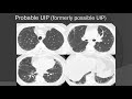 hrct imaging of fibrotic interstitial lung disease new classification of uip