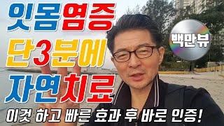 [잇몸염증 자연치료]치은염 치주염 단3분👌즉시 효과/간단하게 잇몸치료😃이빨이 치주염으로 아플때/ 잇몸고름 치통 순삭 경험하고 바로 간단한 자연치료 건강꿀팁 공유👍👍👍